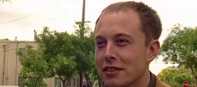 elon-musk-hair-transplant-1