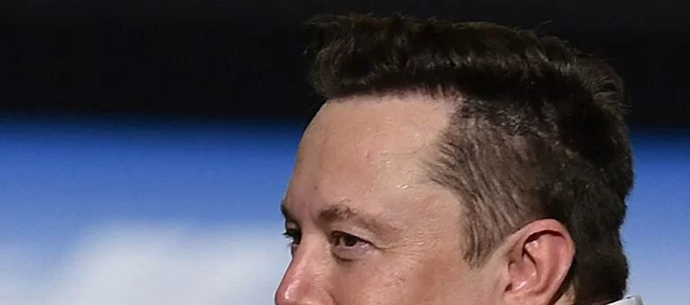 elon-musk-hair-transplant-3