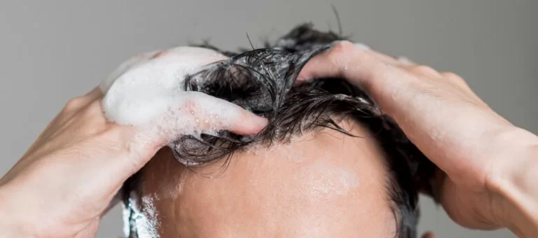 hair-transplant-1